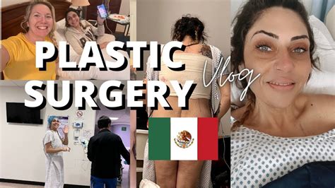 Tummy Tuck Surgery Tijuana, Mexico 